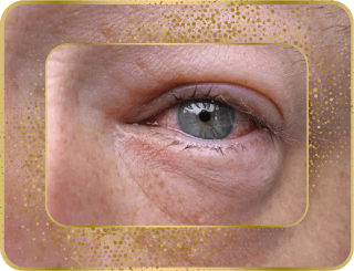 دلایل التهاب و قزمزی چشم ها چیست؟