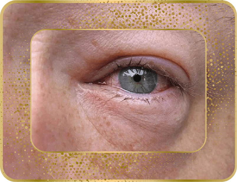 دلایل التهاب و قزمزی چشم ها چیست؟