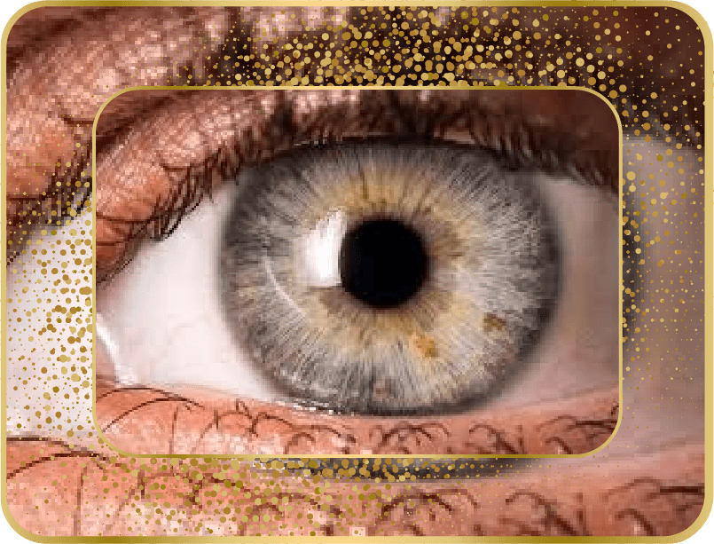بیماری های قرنیه چشم